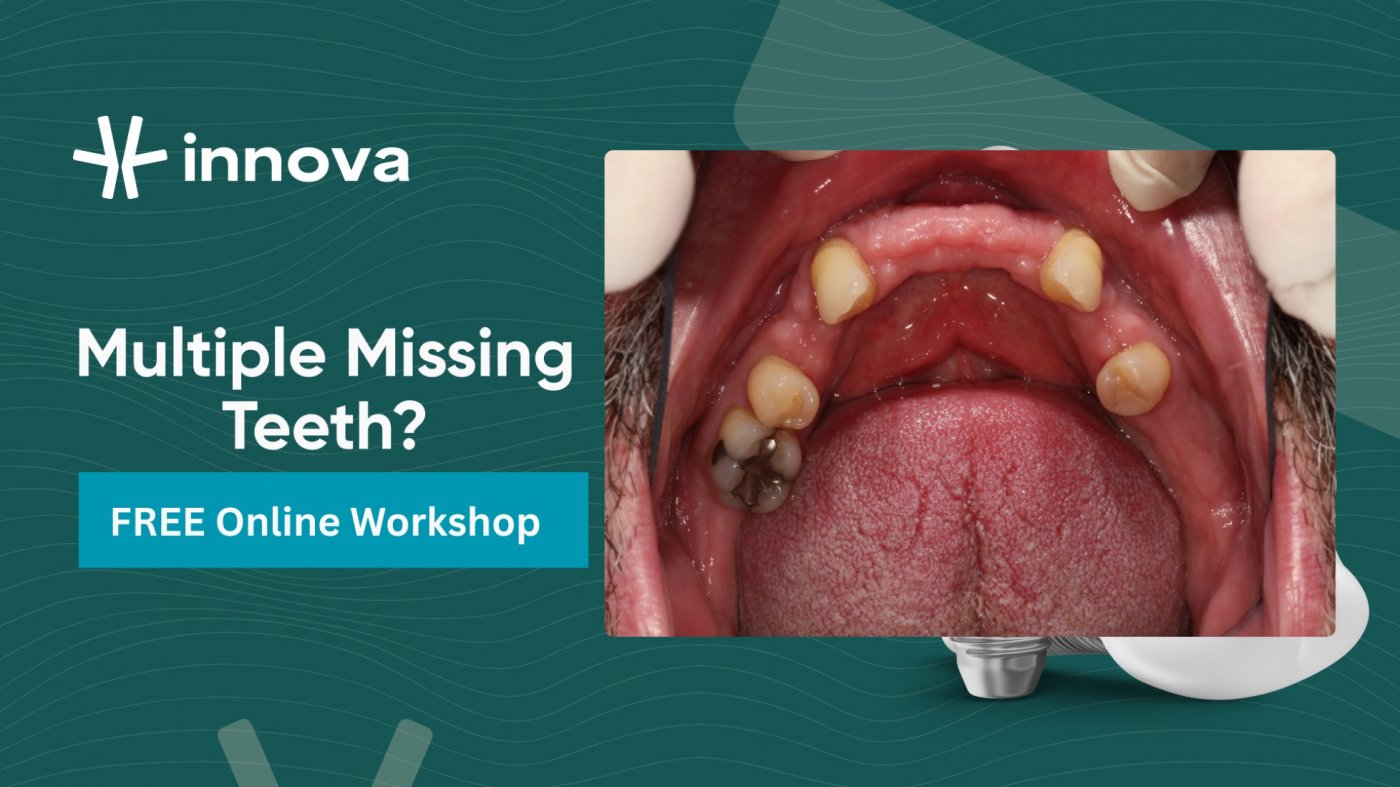 Multiple Missing Teeth? FREE Workshop about Full Mouth Restoration Options in Brunswick